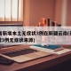 31省新增本土无症状3例在新疆云南(新疆新增3例无症状来源)